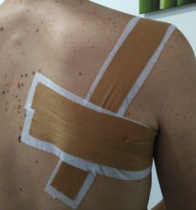 para que sirve el vendaje terapeutico